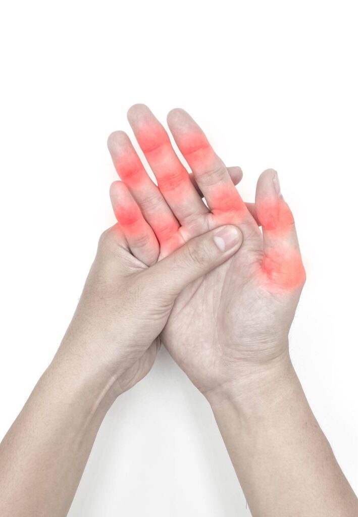 ¿Puede el masaje ayudar a la artritis?